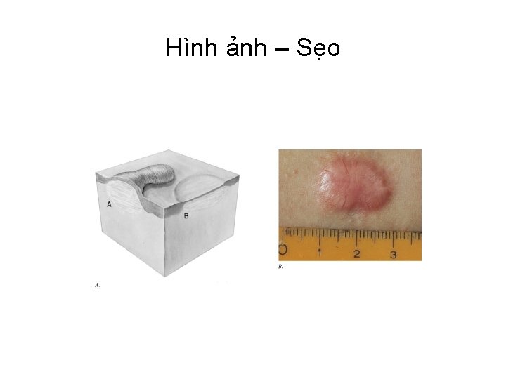 Hình ảnh – Sẹo 