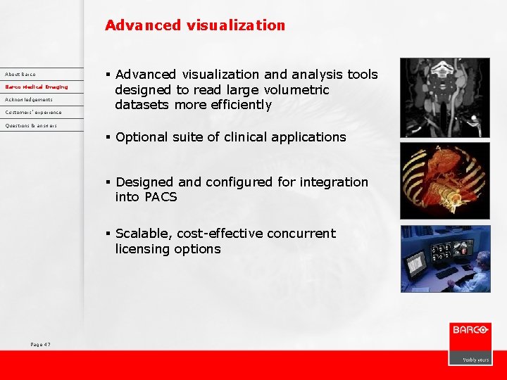 Advanced visualization About Barco Medical Imaging Acknowledgements Customers’ experience § Advanced visualization and analysis