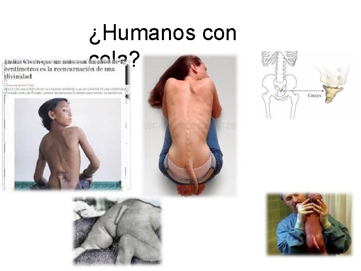 ¿Humanos con cola? 