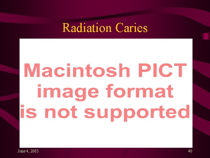 Radiation Caries June 4, 2003 40 