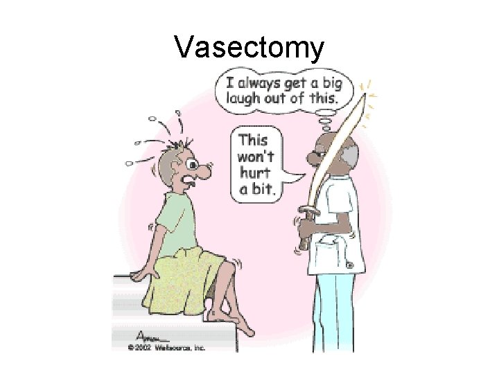 Vasectomy 