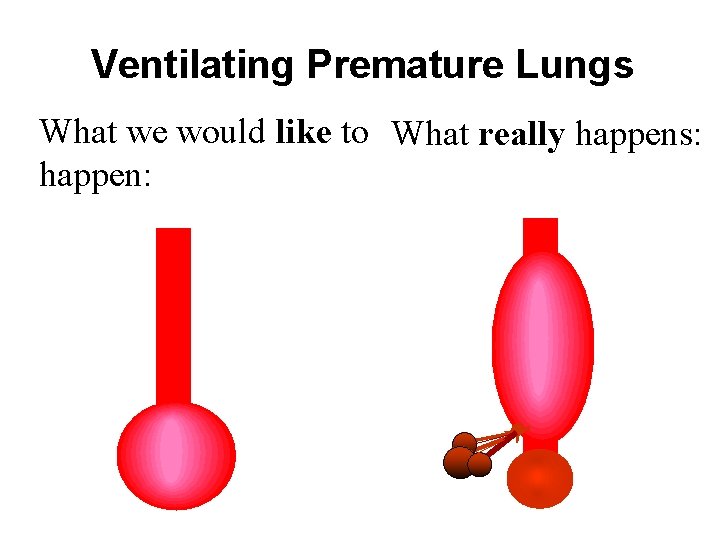 Ventilating Premature Lungs What we would like to What really happens: happen: 