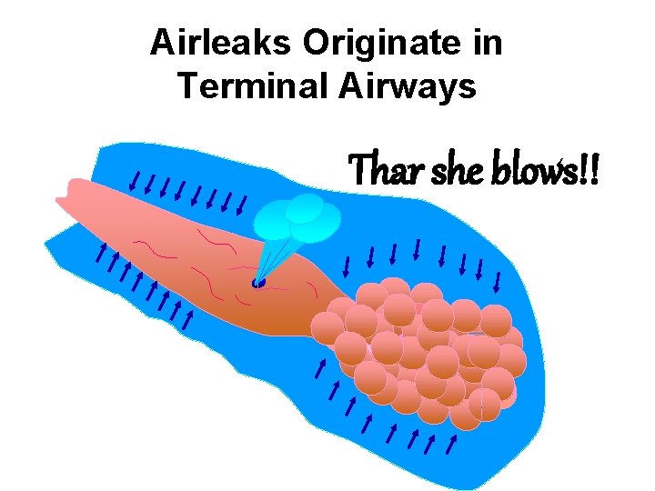 Airleaks Originate in Terminal Airways Thar she blows!! Airleaks Originate in Terminal Airways Thar she blows!!