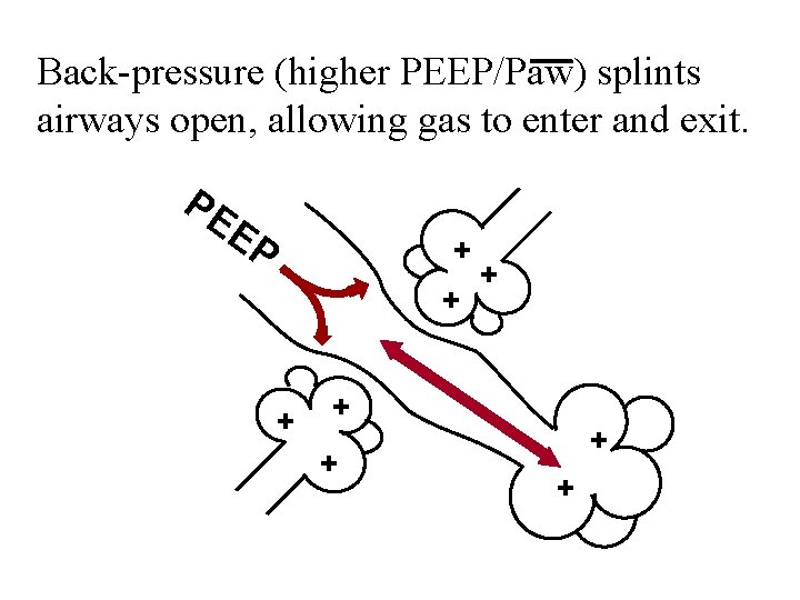 Back-pressure (higher PEEP/Paw) splints airways open, allowing gas to enter and exit. PE EP