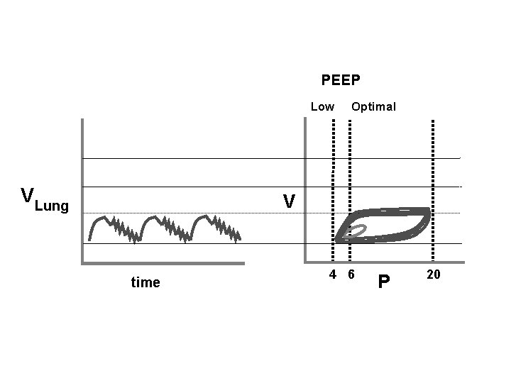 PEEP Low V Lung Optimal V time 4 6 P 20 