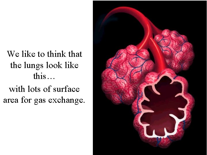 We like to think that the lungs look like this… with lots of surface We like to think that the lungs look like this… with lots of surface