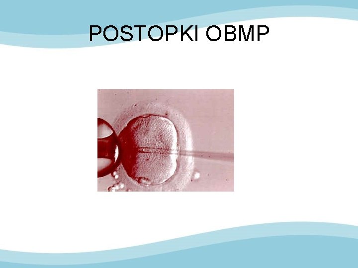 POSTOPKI OBMP 