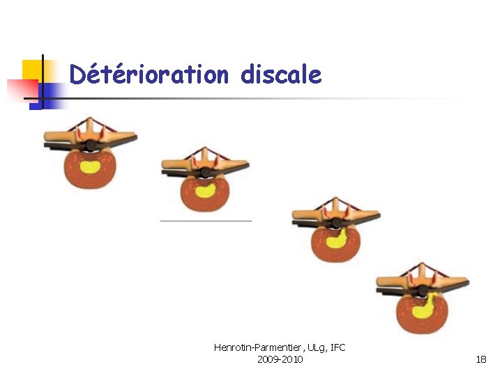 Détérioration discale Henrotin-Parmentier, ULg, IFC 2009 -2010 18 