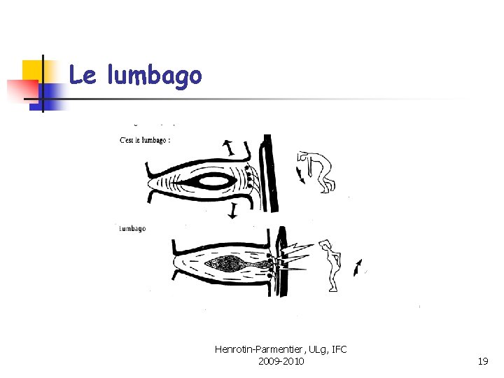 Le lumbago Henrotin-Parmentier, ULg, IFC 2009 -2010 19 