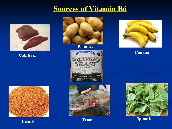 Sources of Vitamin B 6 Potatoes Banana Calf liver Lentils Trout Spinach 