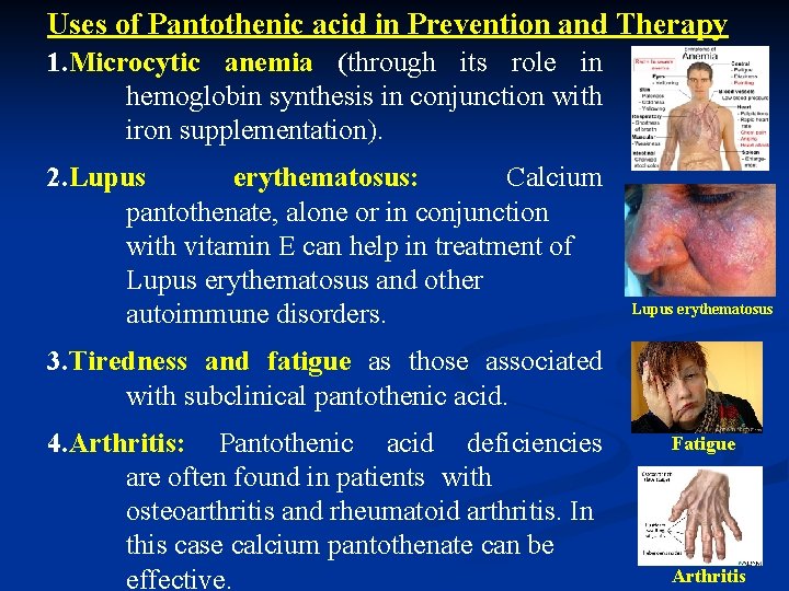 Uses of Pantothenic acid in Prevention and Therapy 1. Microcytic anemia (through its role