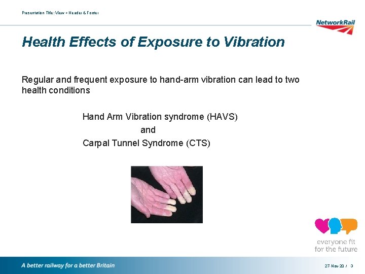 Presentation Title: View > Header & Footer Health Effects of Exposure to Vibration Regular