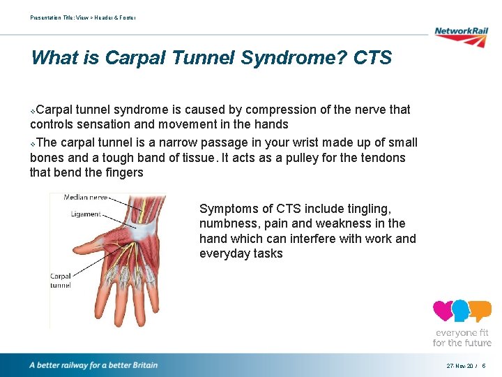 Presentation Title: View > Header & Footer What is Carpal Tunnel Syndrome? CTS Carpal