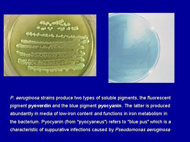 P. aeruginosa strains produce two types of soluble pigments, the fluorescent pigment pyoverdin and