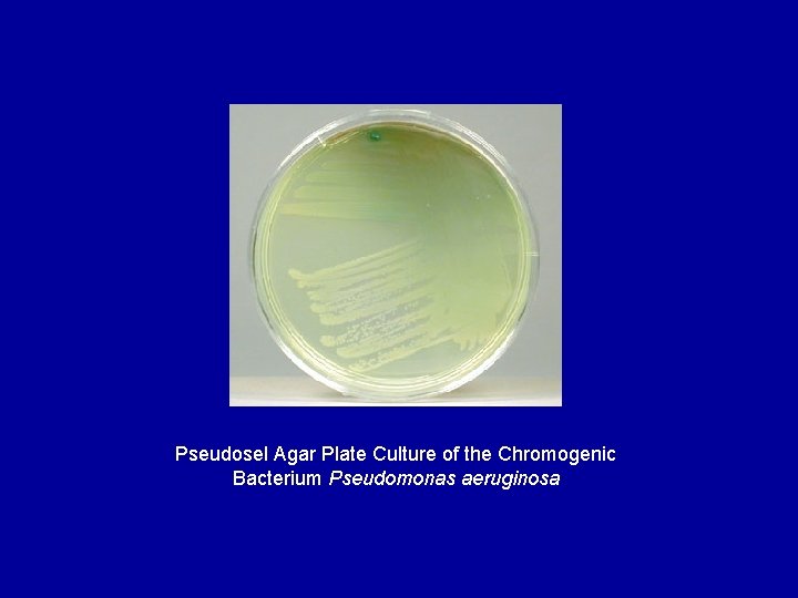 Pseudosel Agar Plate Culture of the Chromogenic Bacterium Pseudomonas aeruginosa 
