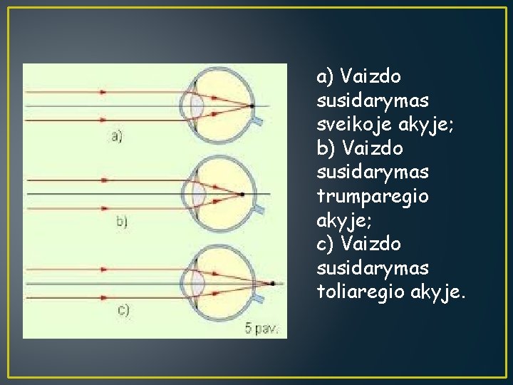 a) Vaizdo susidarymas sveikoje akyje; b) Vaizdo susidarymas trumparegio akyje; c) Vaizdo susidarymas toliaregio