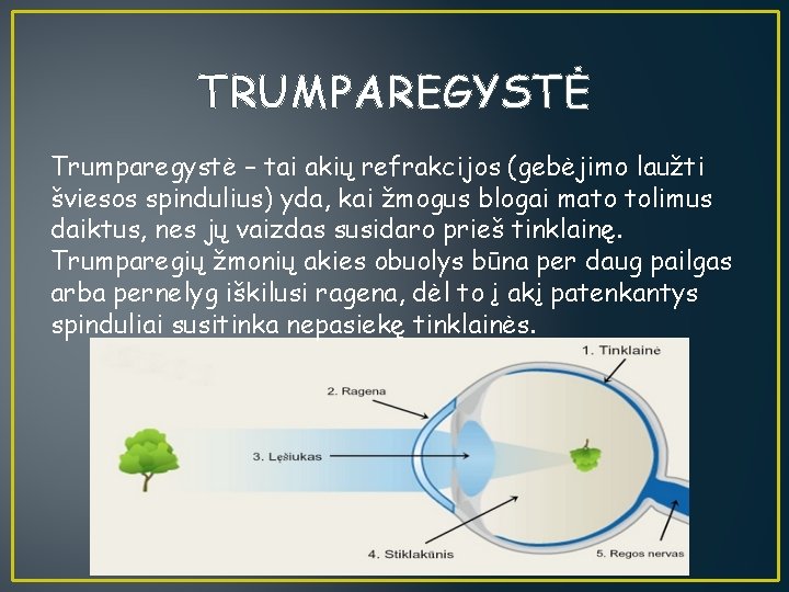 TRUMPAREGYSTĖ Trumparegystė – tai akių refrakcijos (gebėjimo laužti šviesos spindulius) yda, kai žmogus blogai