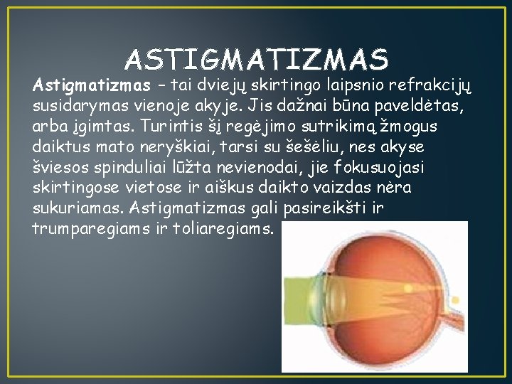 ASTIGMATIZMAS Astigmatizmas – tai dviejų skirtingo laipsnio refrakcijų susidarymas vienoje akyje. Jis dažnai būna