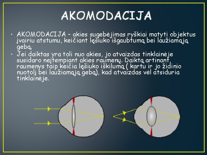 AKOMODACIJA • AKOMODACIJA – akies sugebėjimas ryškiai matyti objektus įvairiu atstumu, keičiant lęšiuko išgaubtumą