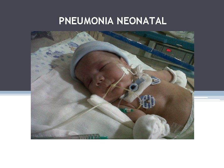 PNEUMONIA NEONATAL 