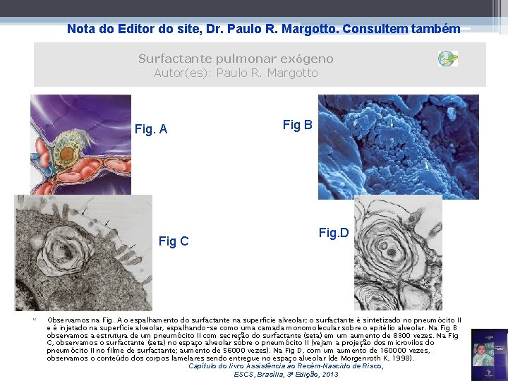 Nota do Editor do site, Dr. Paulo R. Margotto. Consultem também Surfactante pulmonar exógeno