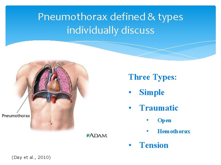 Pneumothorax defined & types individually discuss Three Types: • Simple • Traumatic • Open