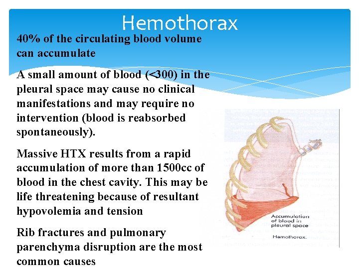 Hemothorax 40% of the circulating blood volume can accumulate A small amount of blood