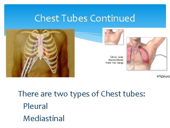 Chest Tubes Continued There are two types of Chest tubes: Pleural Mediastinal 