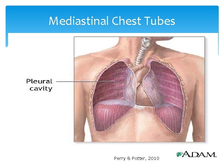 Mediastinal Chest Tubes Perry & Potter, 2010 