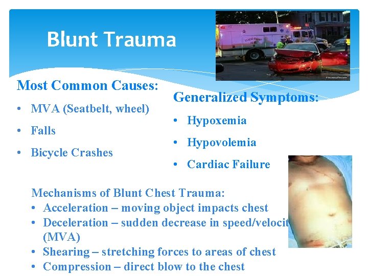 Blunt Trauma Most Common Causes: • MVA (Seatbelt, wheel) • Falls • Bicycle Crashes