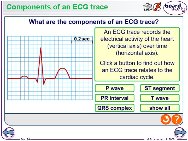 Components of an ECG trace 24 of 24 © Boardworks Ltd 2008 