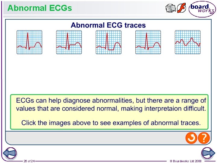 Abnormal ECGs 26 of 24 © Boardworks Ltd 2008 