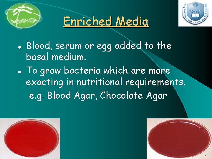 Enriched Media l l Blood, serum or egg added to the basal medium. To