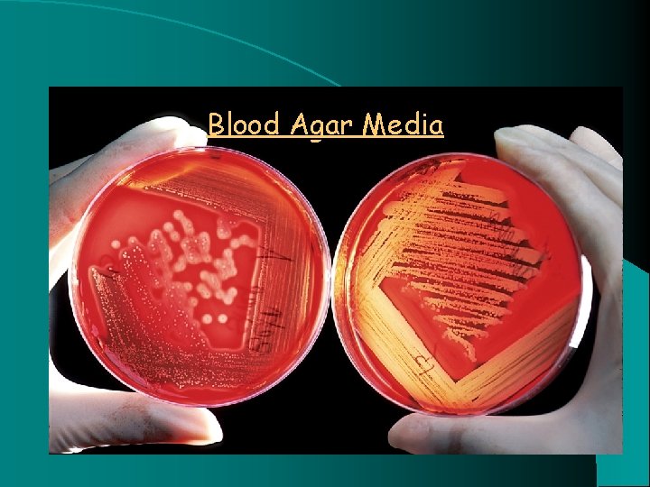 Blood Agar Media 