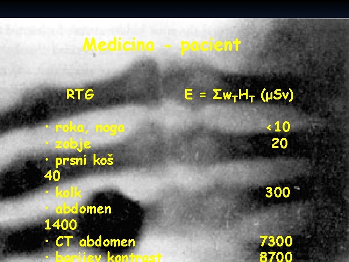 Medicina - pacient RTG • roka, noga • zobje • prsni koš 40 •