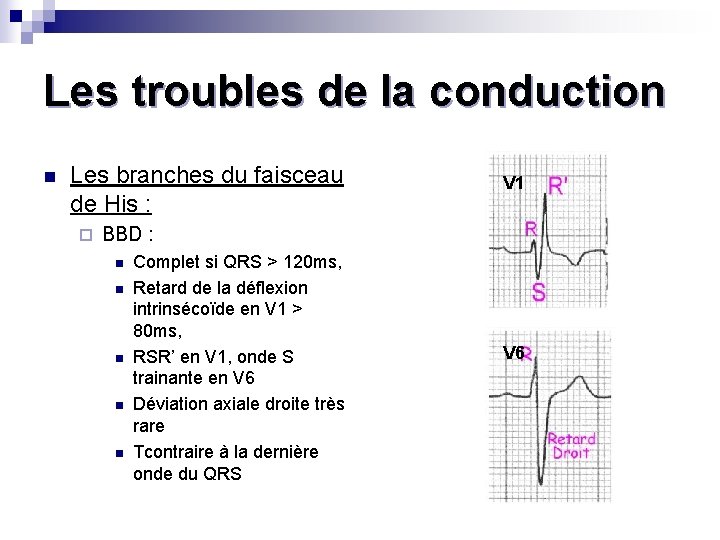 Les troubles de la conduction n Les branches du faisceau de His : ¨