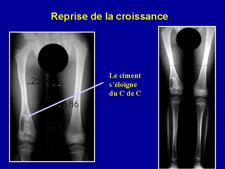 Reprise de la croissance Le ciment s’éloigne du C de C 