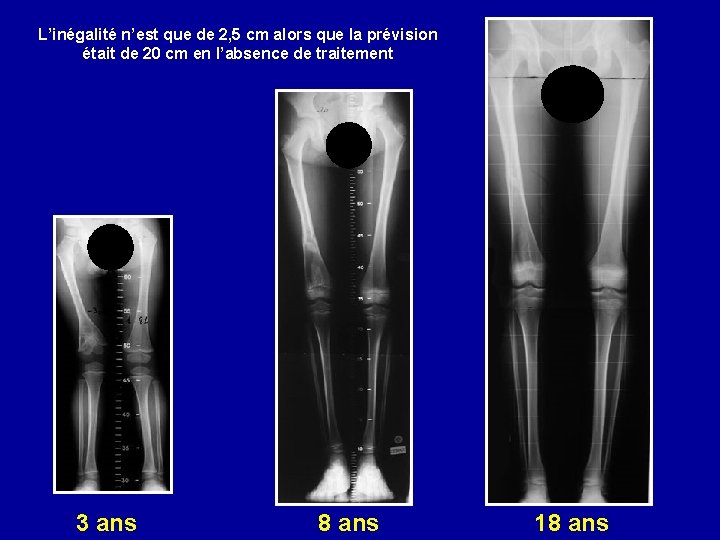 L’inégalité n’est que de 2, 5 cm alors que la prévision était de 20