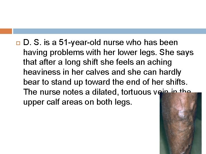 D. S. is a 51 -year-old nurse who has been having problems with D. S. is a 51 -year-old nurse who has been having problems with