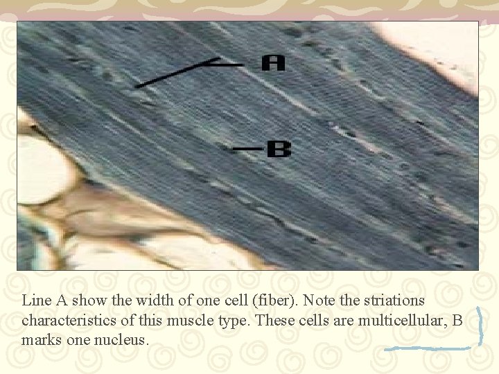 Line A show the width of one cell (fiber). Note the striations characteristics of