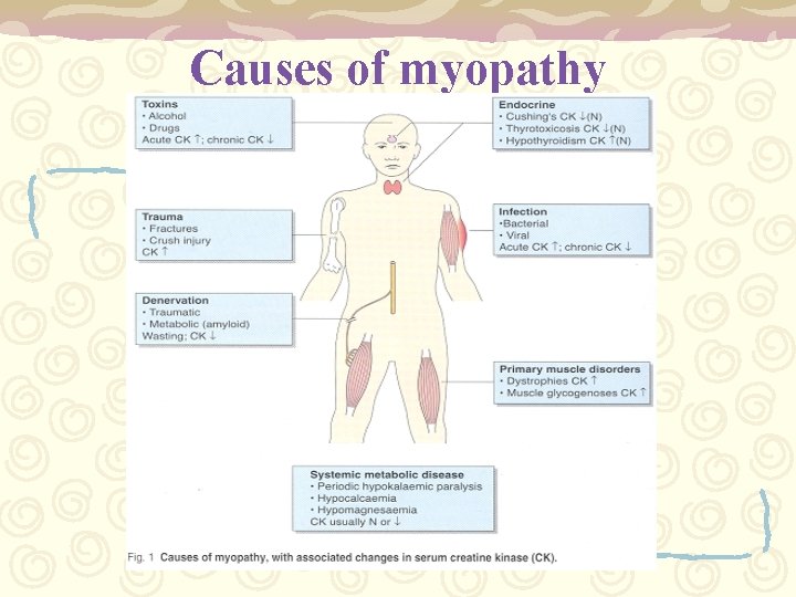 Causes of myopathy 