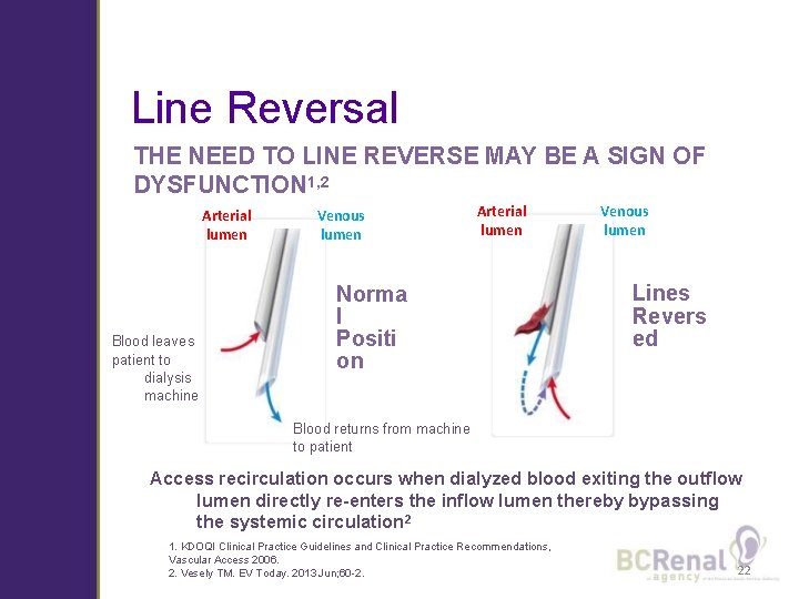 Line Reversal THE NEED TO LINE REVERSE MAY BE A SIGN OF DYSFUNCTION 1,