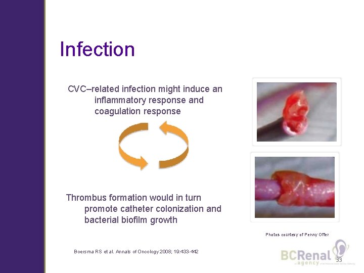 Infection CVC–related infection might induce an inflammatory response and coagulation response Thrombus formation would