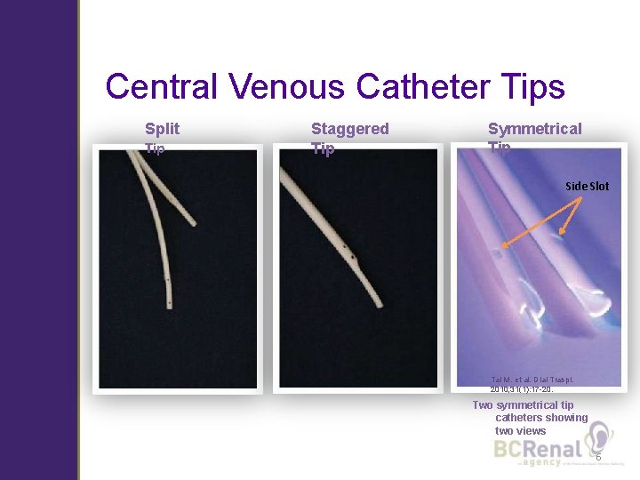 Central Venous Catheter Tips Split Tip Staggered Tip Symmetrical Tip Side Slot Tal M.