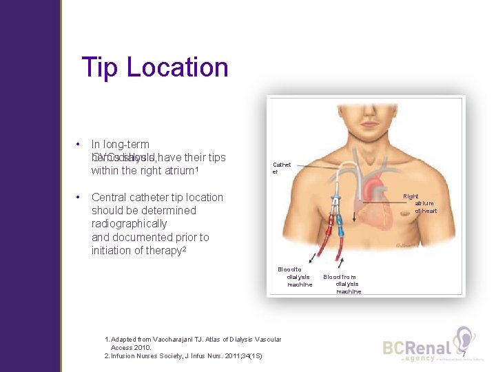 Tip Location • • In long-term CVCs should have their tips hemodialysis, within the