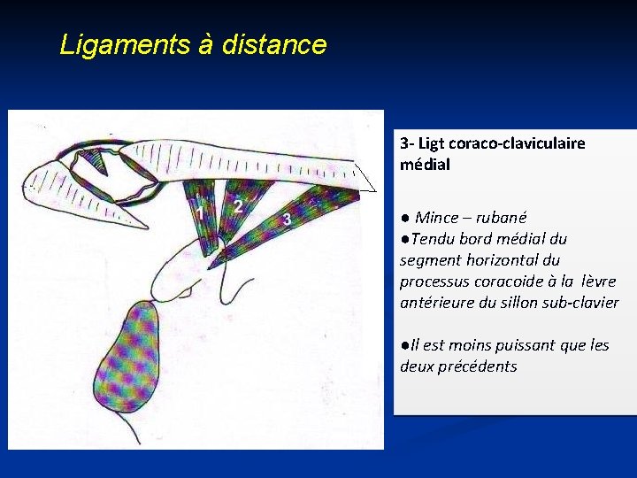 Ligaments à distance 3 - Ligt coraco-claviculaire médial ● Mince – rubané ●Tendu bord