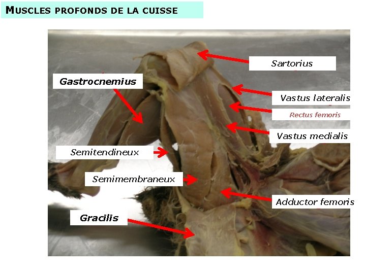 MUSCLES PROFONDS DE LA CUISSE Sartorius Gastrocnemius Vastus lateralis Rectus femoris Vastus medialis Semitendineux
