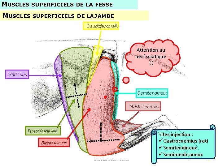 MUSCLES SUPERFICIELS DE LA FESSE MUSCLES SUPERFICIELS DE LA JAMBE Caudofemoralis Attention au nerf