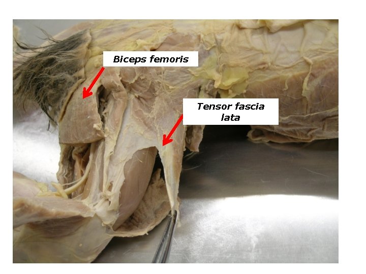 Biceps femoris Tensor fascia lata 