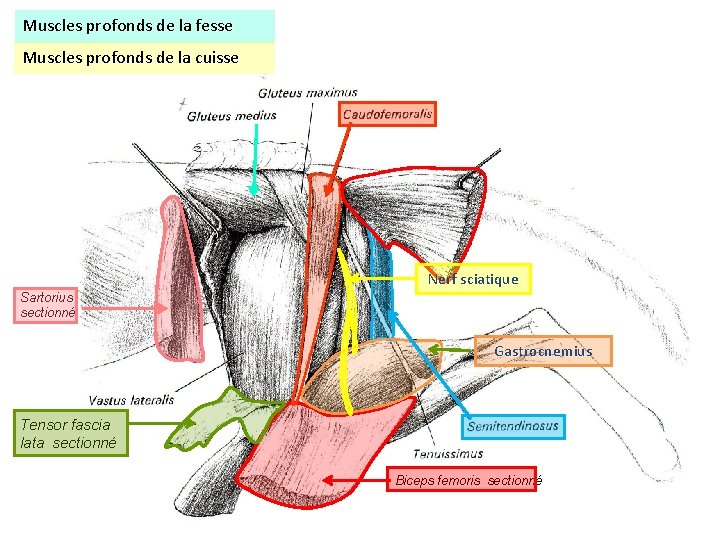 Muscles profonds de la fesse Muscles profonds de la cuisse Nerf sciatique Sartorius sectionné